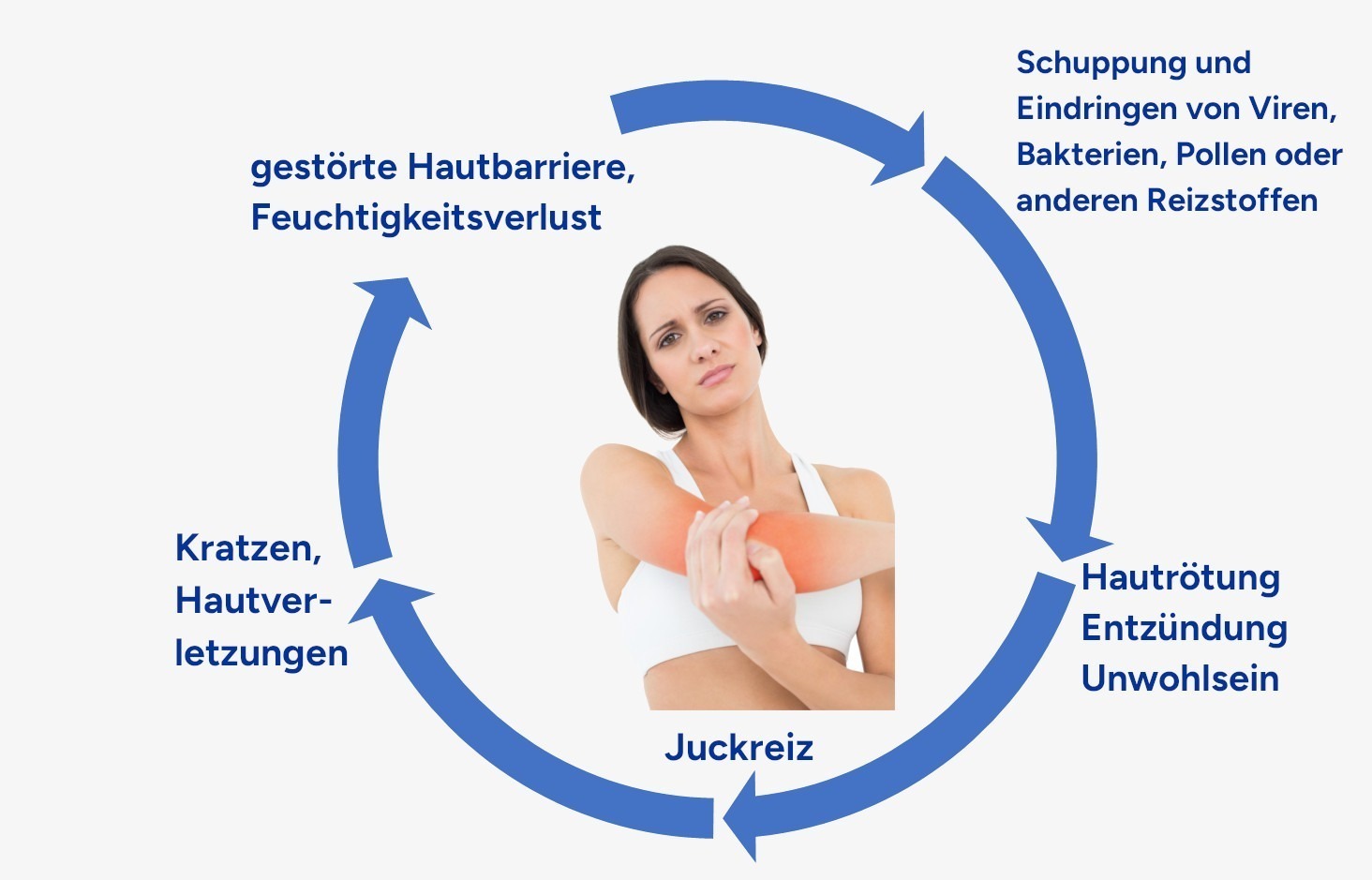 Juck-Kratz-Zyklus von der gestörten Hautbarriere über Schuppung dann Entzündung zu Juckreiz und dem Kratzen hin zur einer erneuten Störung der Hautbarriere.