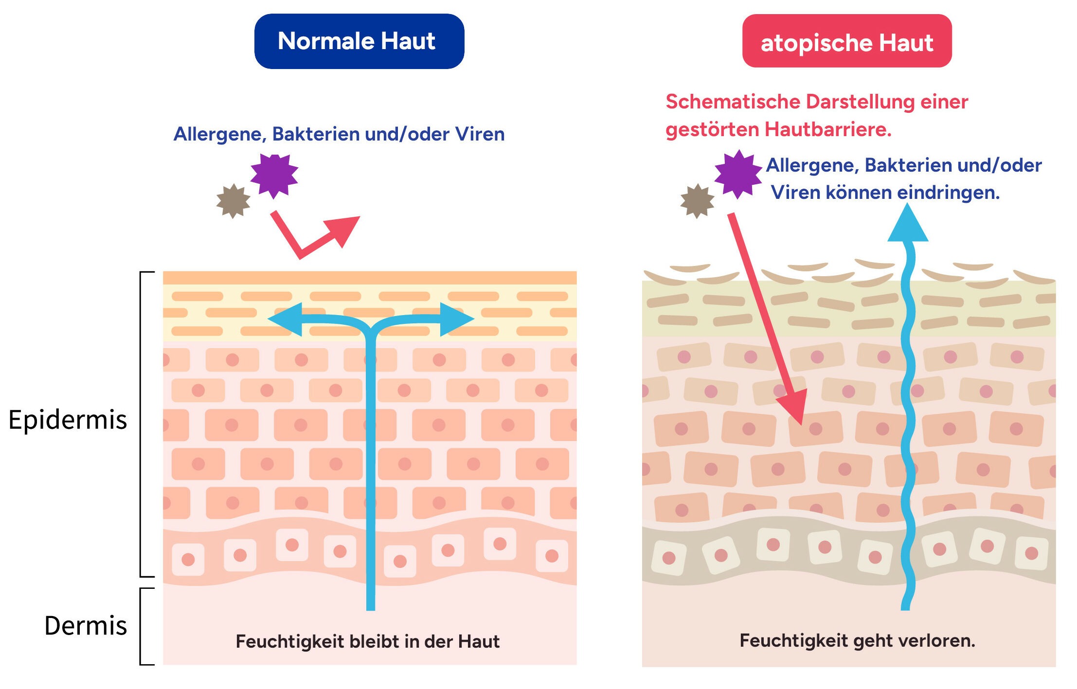 Schemazeichnung von normaler Hautbarriere versus einer gestörten Hautbarriere, bei der Bakterien, Viren und oder andere Umweltfaktoren in die Haut eindringen können.