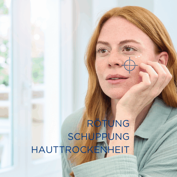 Zeigt eine Frau mit Roten Haaren und den typischen Symptomen bei einem Gesichtsekzem