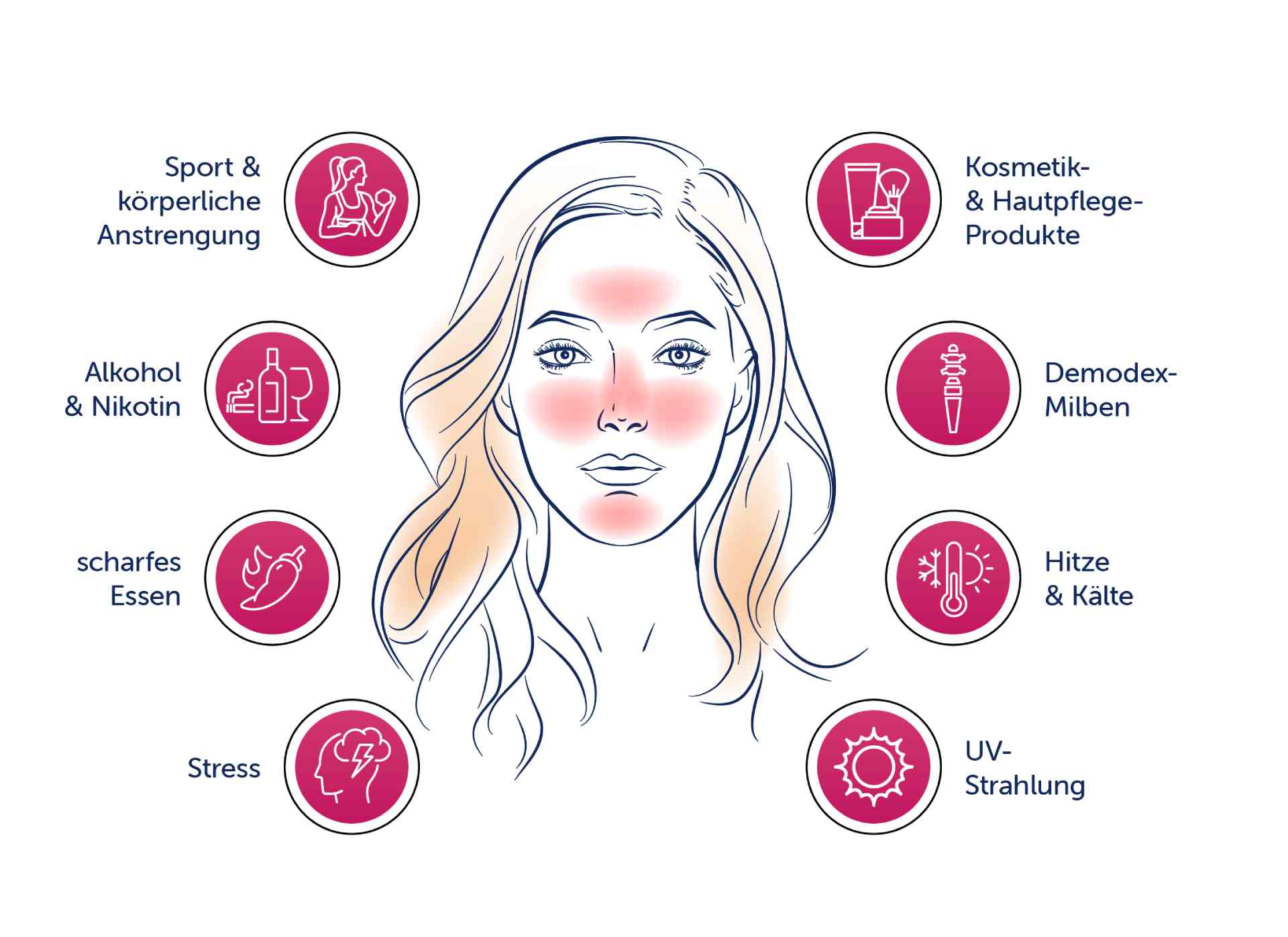 Allergika_Ursachen_Rosacea_Illu Allergika Ursachen Rosacea Illu