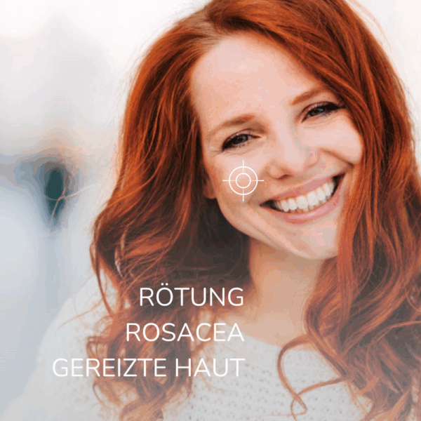 Allergika Getöntes Tagesfluid bei Rosacea – LSF 50+, Anti-Rötung & Pflege