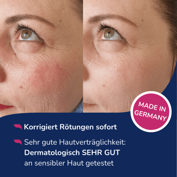 Allergika Anti-Rötung Getöntes Tagesfluid LSF 50+ – Bild 5