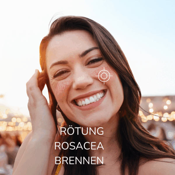 Allergika Rosacea Creme MED – Anti-Rötung & LSF 15 – Medizinprodukt