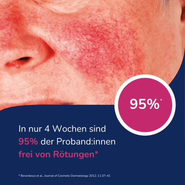 Allergika Rosacea Creme MED – Anti-Rötung & LSF 15 – Medizinprodukt